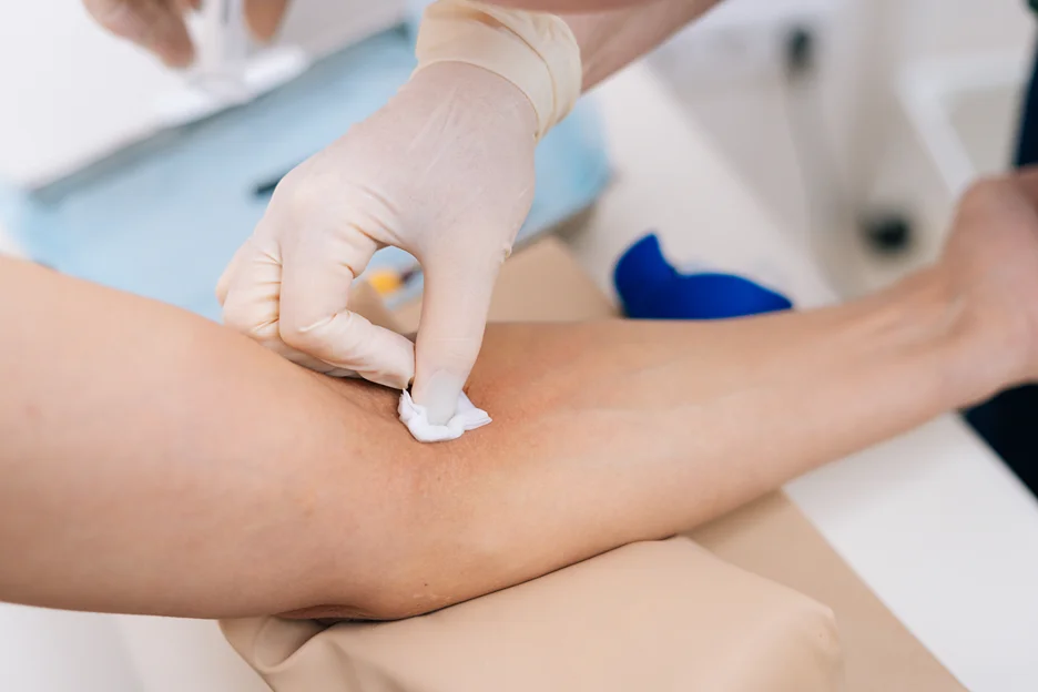 injection process