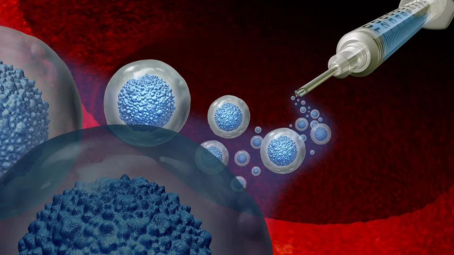 exosome injections
