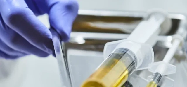 exosomes vs stem cells